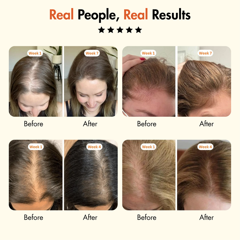 RootRise™ Korea’s #1 Hair Growth Serum