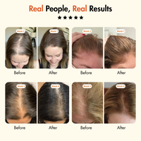 RootRise™ Korea’s #1 Hair Growth Serum
