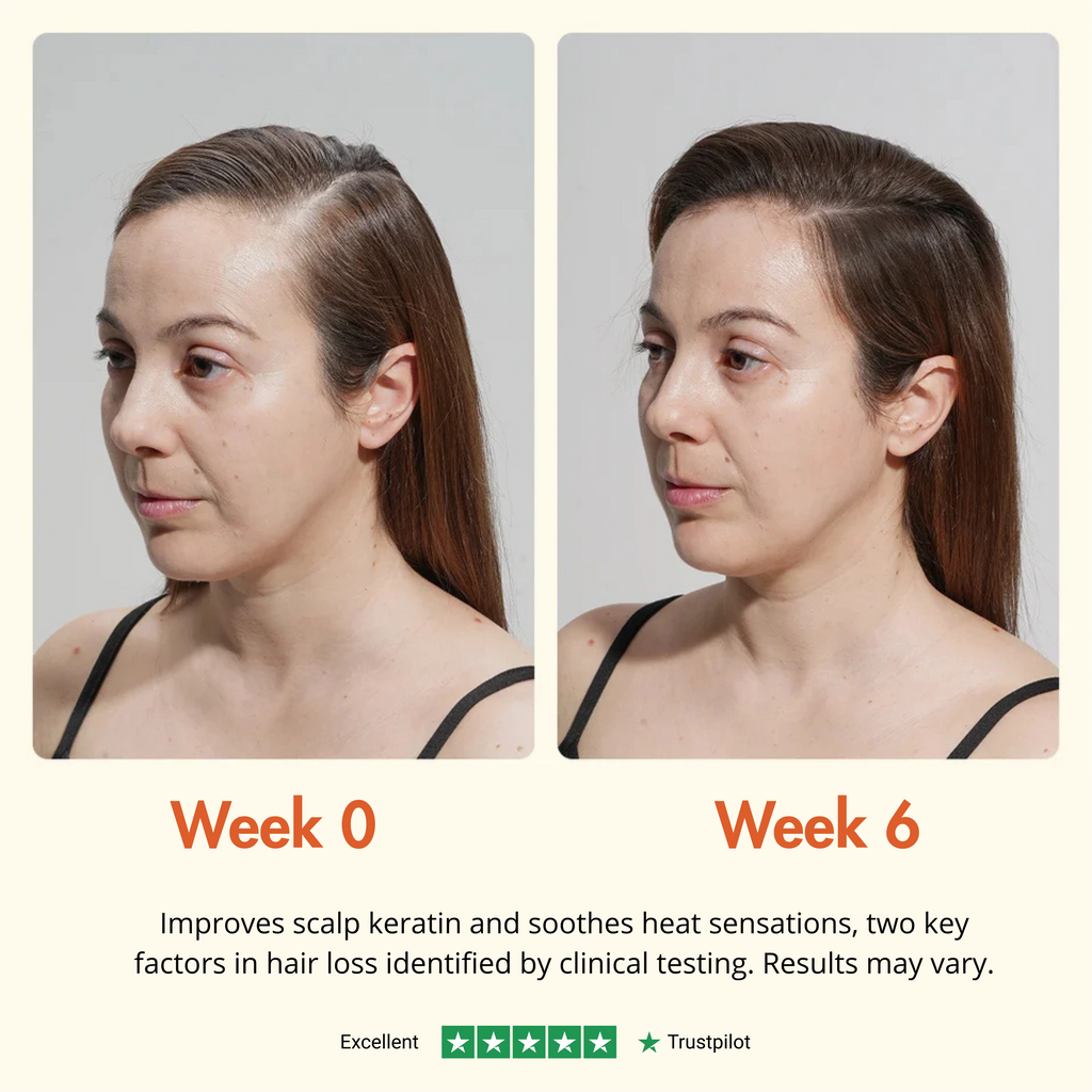 RootRise™ Korea’s #1 Hair Growth Serum